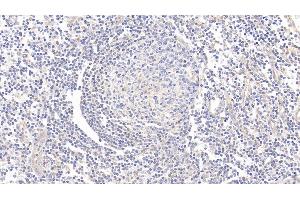 Detection of CD73 in Human Tonsil Tissue using Polyclonal Antibody to Cluster Of Differentiation 73 (CD73) (CD73 anticorps  (AA 29-500))