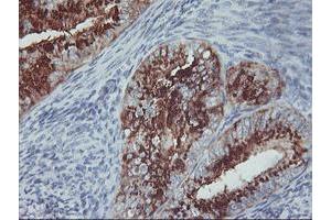 Image no. 8 for anti-Golgi Membrane Protein 1 (GOLM1) antibody (ABIN1498496)