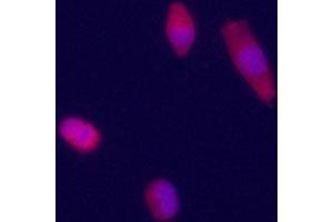 Immunofluorecence staining of GPC3 Antibody on HepG2 cells.