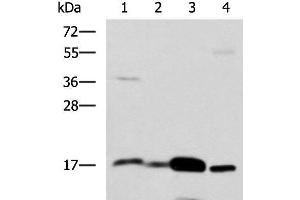 Western blot analysis of Mouse Pancreas tissue Mouse small intestines tissue Mouse large intestine tissue Human sigmoid tissue lysates using ZG16 Polyclonal Antibody at dilution of 1:1350 (ZG16 anticorps)