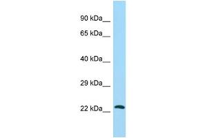 Host: Rabbit Target Name: ATG10 Sample Type: HepG2 Whole Cell lysates Antibody Dilution: 1. (ATG10 anticorps  (C-Term))