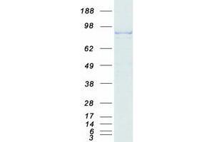 Validation with Western Blot
