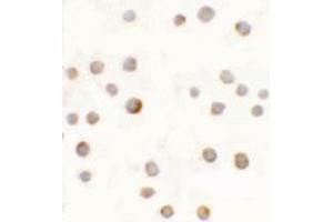 Immunocytochemical anyalysis of 293 cells with ABCA7 polyclonal antibody  at 5 ug/mL. (ABCA7 anticorps  (N-Term))