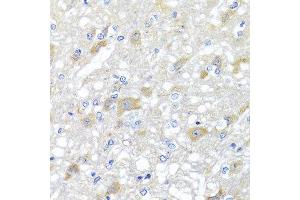 Immunohistochemistry of paraffin-embedded rat brain using INPP5K antibody at dilution of 1:100 (x40 lens). (INPP5K anticorps)