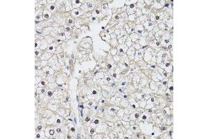 Immunohistochemistry of paraffin-embedded human liver using CDK7 antibody.