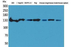 Western Blotting (WB) image for anti-Interleukin 16 (IL16) (C-Term) antibody (ABIN3178206) (IL16 anticorps  (C-Term))