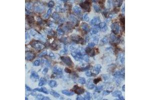 Immunohistochemical analysis of CD122 staining in human lymph node formalin fixed paraffin embedded tissue section. (IL2 Receptor beta anticorps)