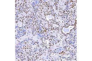 IHC analysis of STAG2 using anti-STAG2 antibody (ABIN7602420).