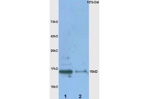 Lane 1: Rat kidney, lysates Lane 2: Rat Brain probed with Rabbit Anti-Metallothionein Polyclonal Antibody, Unconjugated  at 1:3000 for 90 min at 37˚C.