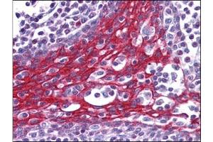 Immunohistochemistry Image: Human Tonsil: Formalin-Fixed, Paraffin-Embedded (FFPE)