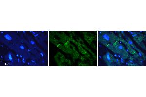 Rabbit Anti-CERS2 Antibody   Formalin Fixed Paraffin Embedded Tissue: Human heart Tissue Observed Staining: Plasma membrane in intercalated disk Primary Antibody Concentration: 1:100 Other Working Concentrations: N/A Secondary Antibody: Donkey anti-Rabbit-Cy3 Secondary Antibody Concentration: 1:200 Magnification: 20X Exposure Time: 0.