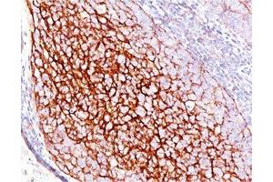IHC testing of human tonsil stained with CD35 antibody (E11). (CD35 anticorps)