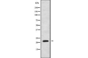 Western blot analysis NOLA1 using HUVEC whole cell lysates (GAR1 anticorps  (Internal Region))