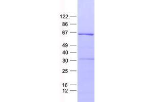 Validation with Western Blot