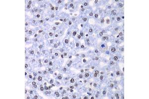 Immunohistochemistry of paraffin-embedded rat liver using SF3B2 antibody. (SF3B2 anticorps  (AA 616-895))