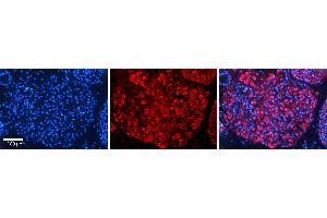 Rabbit Anti-SAAntibody   Formalin Fixed Paraffin Embedded Tissue: Human Testis Tissue Observed Staining: Cytoplasm in spermatogonia and spermatocytes Primary Antibody Concentration: N/A Other Working Concentrations: 1:600 Secondary Antibody: Donkey anti-Rabbit-Cy3 Secondary Antibody Concentration: 1:200 Magnification: 20X Exposure Time: 0.