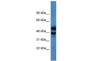 WB Suggested Anti-CYP21A2 Antibody Titration: 0. (CYP21A2 anticorps  (C-Term))