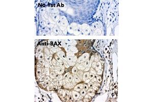 anti-BCL2-Associated X Protein (BAX) (N-Term) antibody