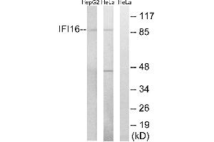 Western blot analysis of extracts from HeLa cells and HepG2 cells, using IFI16 antibody. (IFI16 anticorps  (Internal Region))