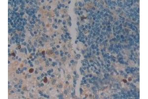 Detection of LEI in Rat Spleen Tissue using Polyclonal Antibody to Leukocyte Elastase Inhibitor (LEI)