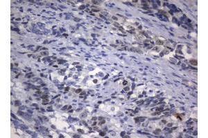 Image no. 2 for anti-Antigen Identified By Monoclonal Antibody Ki-67 (MKI67) (AA 1160-1493) antibody (ABIN1490860) (Ki-67 anticorps  (AA 1160-1493))