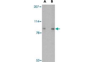 Western blot analysis of VPS53 in 293 cell lysate with VPS53 polyclonal antibody  at (A) 0. (VPS53 anticorps  (C-Term))