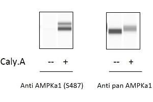 HeLa cells were treated or untreated with Calyculin A.