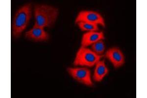 Immunofluorescent analysis of MOK staining in MDAMB231 cells. (MOK anticorps  (Center))