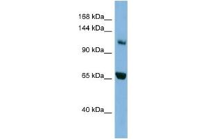 WB Suggested Anti-MYO1E Antibody Titration: 0. (MYO1E anticorps  (Middle Region))