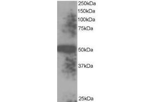 Image no. 1 for anti-Thioredoxin Domain Containing 5 (Endoplasmic Reticulum) (TXNDC5) (C-Term), (Isoform 1), (Isoform 3) antibody (ABIN374463) (TXNDC5 anticorps  (C-Term, Isoform 1, Isoform 3))