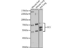 Western blot analysis of extracts of various cell lines, using EED antibody (ABIN6133691, ABIN6139940, ABIN6139943 and ABIN6216521) at 1:3000 dilution.