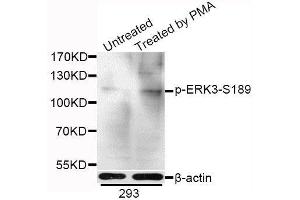 Western blot analysis of extracts of 293 cells, using Phospho-ERK3-S189 antibody.