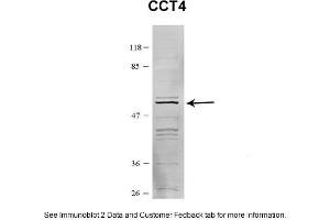 Sample Type: HEK 293 (10ug)Primary Dilution: 1:1000Secondary Antibody: conjugated goat anti-rabbitSecondary Dilution: 1:10,000Image Submitted By: Amy GrayBrigham Young University (CCT4 anticorps  (C-Term))