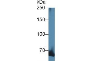Detection of ADD1 in Mouse Serum using Polyclonal Antibody to Alpha Adducin (ADD1)