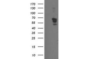 Western Blotting (WB) image for anti-Beclin 1, Autophagy Related (BECN1) antibody (ABIN1496865)