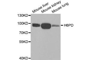 Western blot analysis of extracts of various tissues, using H6PD antibody. (Glucose-6-Phosphate Dehydrogenase anticorps)
