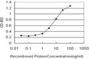 Detection limit for recombinant GST tagged GRK1 is approximately 0. (GRK1 anticorps  (AA 51-150))