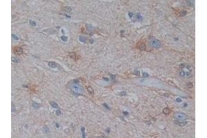 Detection of PSAT1 in Human Cerebrum Tissue using Polyclonal Antibody to Phosphoserine Aminotransferase 1 (PSAT1)