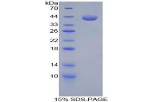 SDS-PAGE analysis of Guinea Pig RANTES Protein. (CCL5 Protéine)