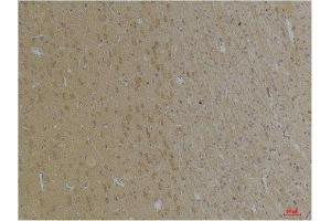 Immunohistochemistry (IHC) analysis of paraffin-embedded Rat Brain Tissue using KCNK4 (TRAAK) Rabbit Polyclonal Antibody diluted at 1:200.