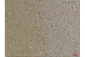 Immunohistochemistry (IHC) analysis of paraffin-embedded Rat Brain Tissue using KCNK4 (TRAAK) Rabbit Polyclonal Antibody diluted at 1:200. (KCNK4 anticorps)