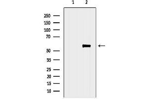 anti-Cystatin SA (CST2) (Internal Region) antibody