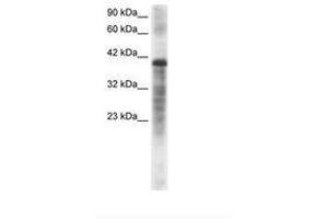 Image no. 2 for anti-Proteasome (Prosome, Macropain) 26S Subunit, ATPase, 3 (PSMC3) (AA 293-339) antibody (ABIN202439)