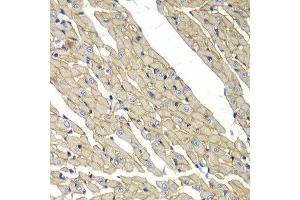 Immunohistochemistry of paraffin-embedded rat heart using SGCD antibody at dilution of 1:100 (x40 lens). (SGCD anticorps)