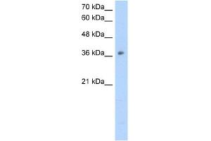 WB Suggested Anti-OTC Antibody Titration:  2. (OTC anticorps  (N-Term))