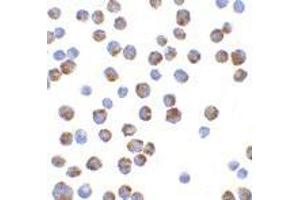 Immunocyochemistry of BIM in K562 cells with AP30151PU-N Bim antibody at 10 μg/ml.