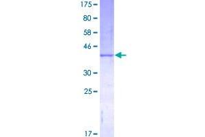 Image no. 1 for Colony Stimulating Factor 2 (Granulocyte-Macrophage) (CSF2) (AA 1-144) protein (GST tag) (ABIN1350496)