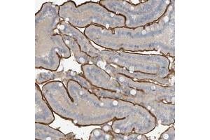Immunohistochemical staining of human duodenum with ZNF793 polyclonal antibody  shows strong luminal membranous positivity in glandular cells at 1:200-1:500 dilution. (ZNF793 anticorps)
