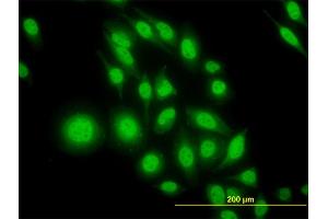 Immunofluorescence of monoclonal antibody to ATF4 on HeLa cell. (ATF4 anticorps  (AA 171-270))