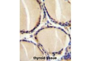 CALCA Antibody (Center) immunohistochemistry analysis in formalin fixed and paraffin embedded human thyroid tissue followed by peroxidase conjugation of the secondary antibody and DAB staining.